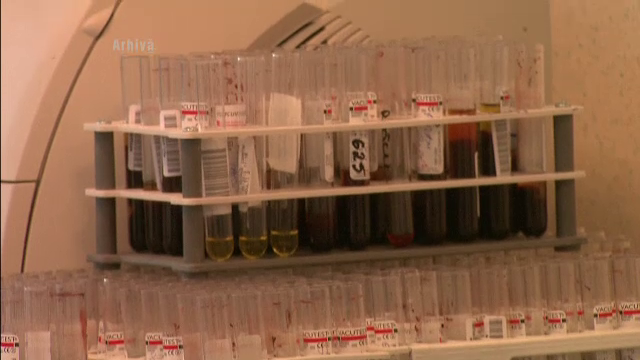 Zeci de persoane din Satu Mare au fost depistate hepatita de tip B sau C