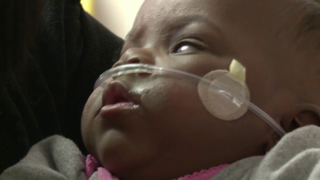 Unul dintre cei mai mici prunci din lume, care cantarea la nastere mai putin de 300 de grame, a fost externat