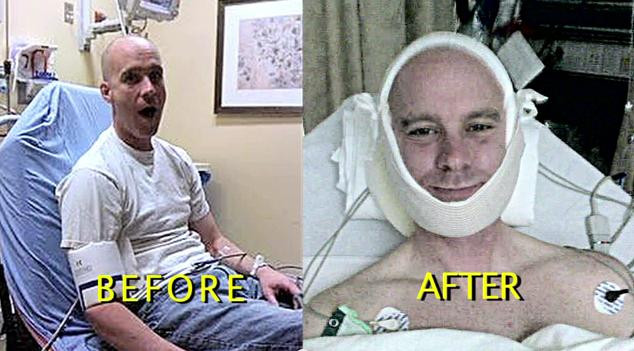 Cele mai ciudate rani: Povestea femeii care a surzit, dupa un sarut. Soferul care si-a dublat marimea, in cateva secunde