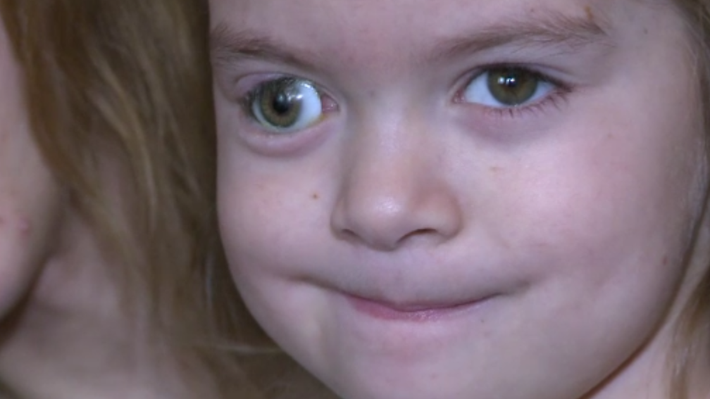 Proteza speciala pentru o fetita de cinci ani. O echipa de medici se pregateste de o operatie complicata