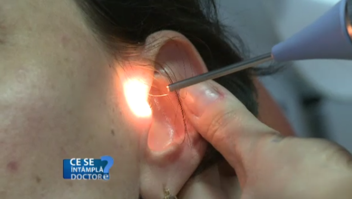 Pierderea partiala a auzului sau vazului poate semnala o problema neurologica grava, care necesita un diagnostic