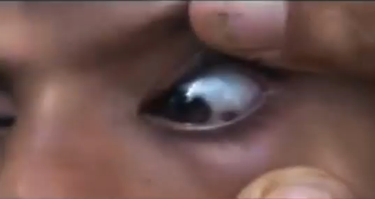 Doctorii nu au nicio explicatie pentru lacrimile ei. Localnicii se tem ca ar fi posedata