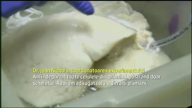 Experiment revolutionar in SUA. Metoda prin care cercetatorii au reusit sa "cultive" in laborator prima pereche de plamani