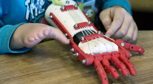 Baiatul de 9 ani, nascut fara degete, a primit un cadou neasteptat. Cum a fost realizata proteza revolutionara