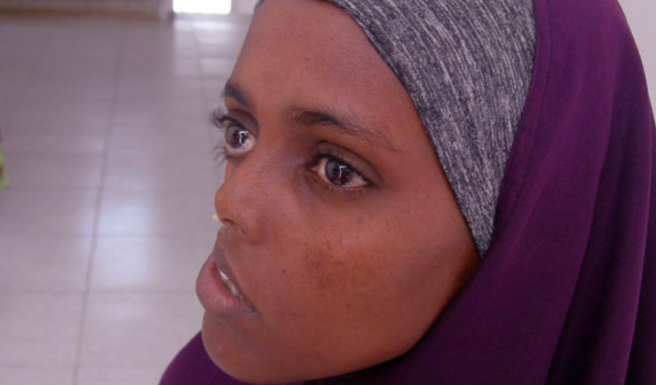 Femeia care a asteptat 23 de ani pentru un chip nou. Visul unei victime a Razboiului Civil din Somalia