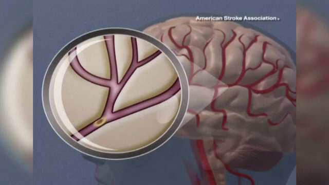 Vremea rece, asociata cu o boala care ucide sute de mii de oameni. Descoperirile facute recent de medici