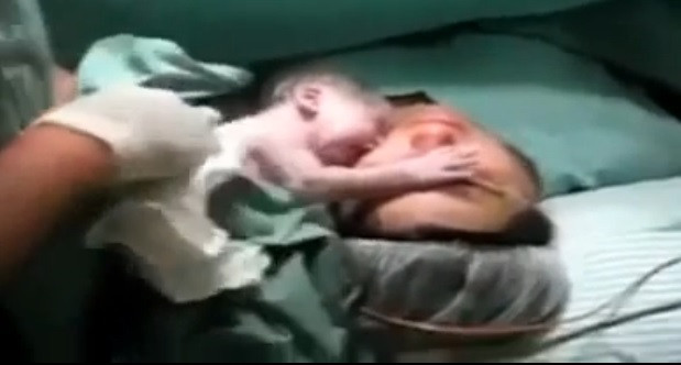Imagini emotionante cu un bebelus care refuza sa se desprinsa de mama lui, dupa ce s-a nascut prin cezariana. VIDEO