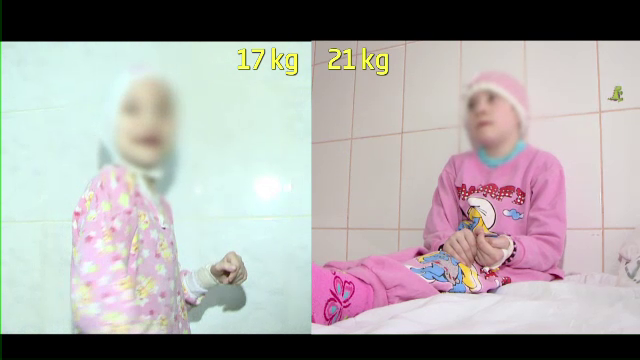 Tanara care la 19 ani cantarea doar 16 kilograme se simte tot mai bine. Fata a luat in greutate 6 kilograme