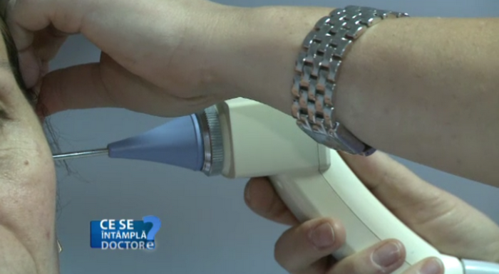 Perforatiile timpanului pot duce la complicatii serioase. Ce trebuie sa faceti atunci cand va raniti cu un betisor de ureche