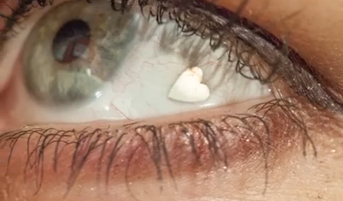 Ce risca femeia care a cheltuit mii de dolari ca sa aiba implanturi sub forma de inima in ochi