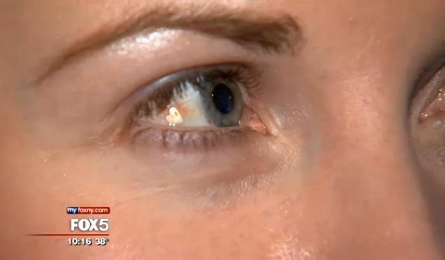 Costa 3000 de dolari si risti sa faci infectie. Bijuteriile implantate in ochi sunt la mare cautare