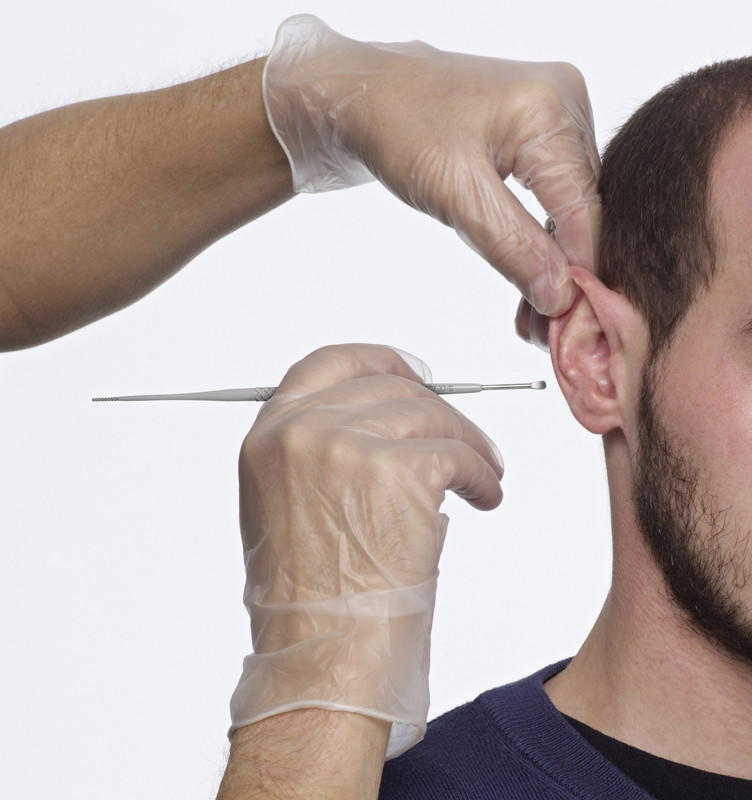 Ce au gasit medicii in urechea unui barbat din Marea Britanie. "A fost groaznic sa stiu ca imi zboara in cap"