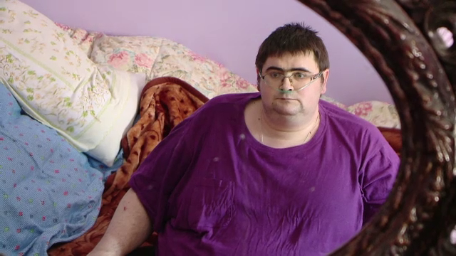 Barbatul de 300 de kilograme din Pascani a murit. Ficatul sau cantarea 20kg iar inima functiona la doar 20% din capacitate