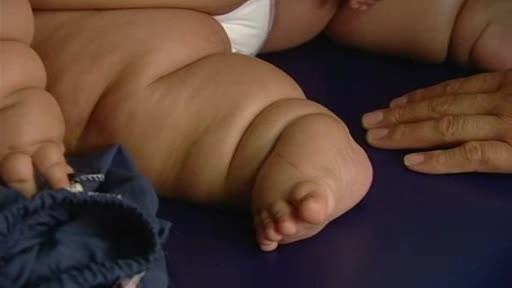 A ajuns la 21 de kilograme la 8 luni dupa nastere. Explicatia medicilor pentru starea bebelusului din Columbia