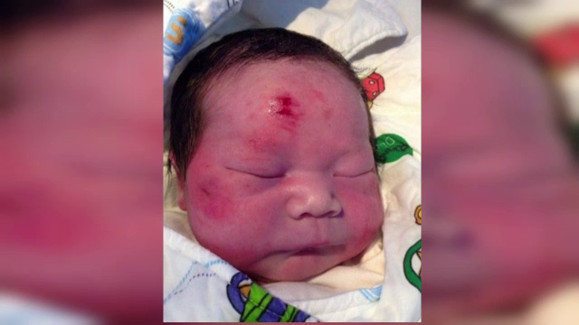 "Copilul miracol" a venit pe lume in timp ce mama murea intr-un accident rutier