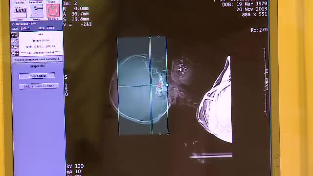 Romancele au ajuns victimele propriilor relatii. O tanara din Bistrita si-a fracturat coloana, fugind de sotul violent