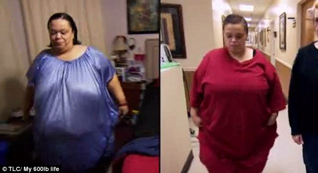 Stomacul ei are acum dimensiunile unui ou. Cum a reusit o femeie sa slabeasca 127 de kilograme intr-un an