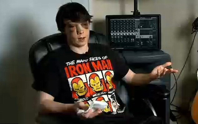 A fost operat de urgenta, dupa ce a primit doi pumni in fata. Povestea elevului din SUA batut de un coleg de liceu