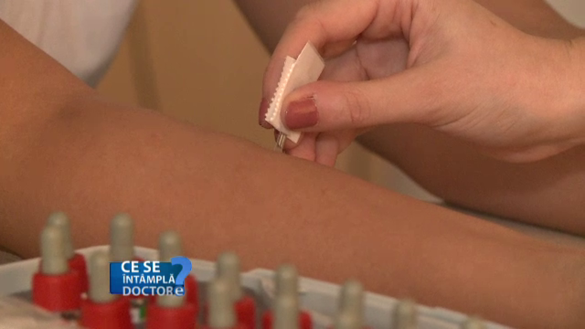 Cum puteti scapa de alergiile alimentare si respiratorii. Produsele care trebuie excluse din alimentatie