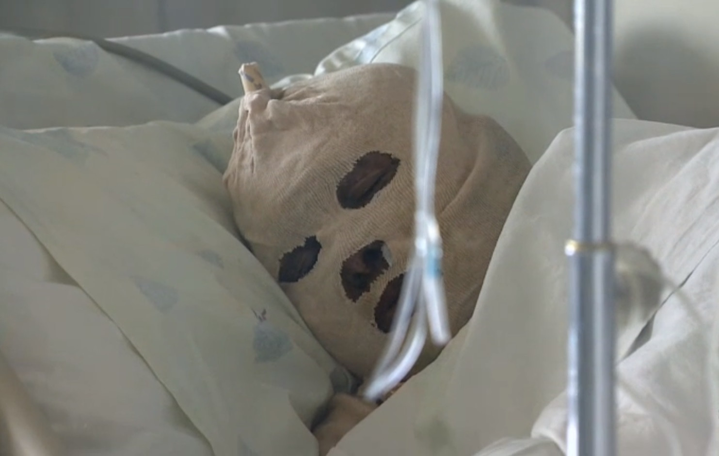 "Ardea ca o torta vie". Drama unei mame din Siria care si-a dat foc pentru ca nu avea cu ce sa isi hraneasca cei patru copii