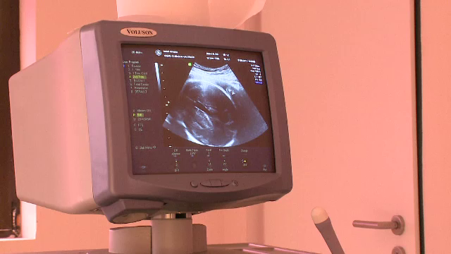 86% dintre femeile care nasc prin cezariana risca astfel de tumori benigne. Cum se trateaza fibromul uterin