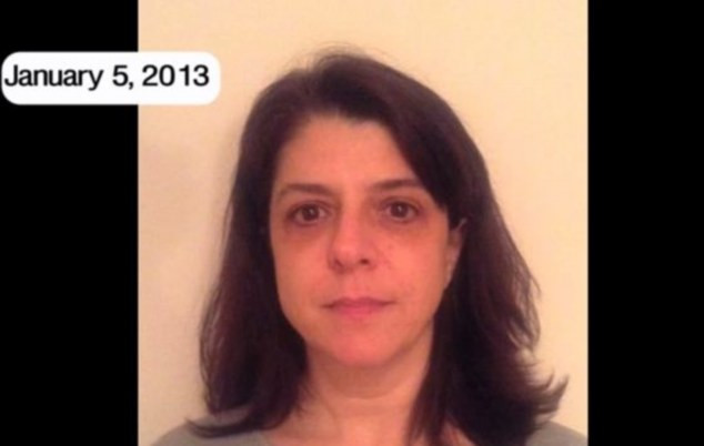 O femeie din SUA si-a documentat, timp de un an, transformarile prin care a trecut dupa ce a aflat ca are cancer. VIDEO