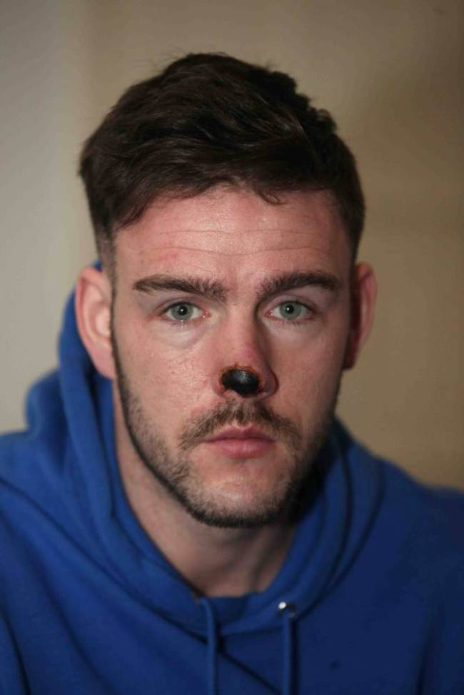 A ramas fara nas in plina strada. Medicii nu au stiut ce sa faca pentru el cand l-au vazut in ce stare era