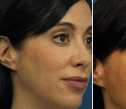 A cheltuit 15.000 de dolari doar ca sa fie admirata in pozele de pe Facebook. Cum arata acum tanara. FOTO