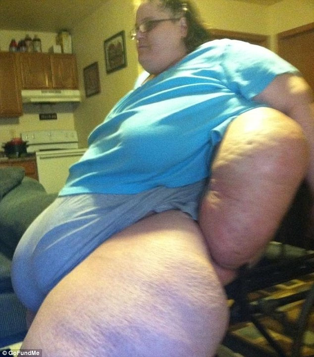 Cea mai grasa femeie din lume vrea sa dea jos din cele 347 kilograme, dar nu are bani sa ajunga la spital pentru operatie