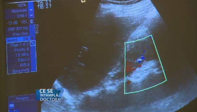 Nu neglijati tulburarile menstruale care apar dupa varsta de 18 ani. Pot trada boli grave