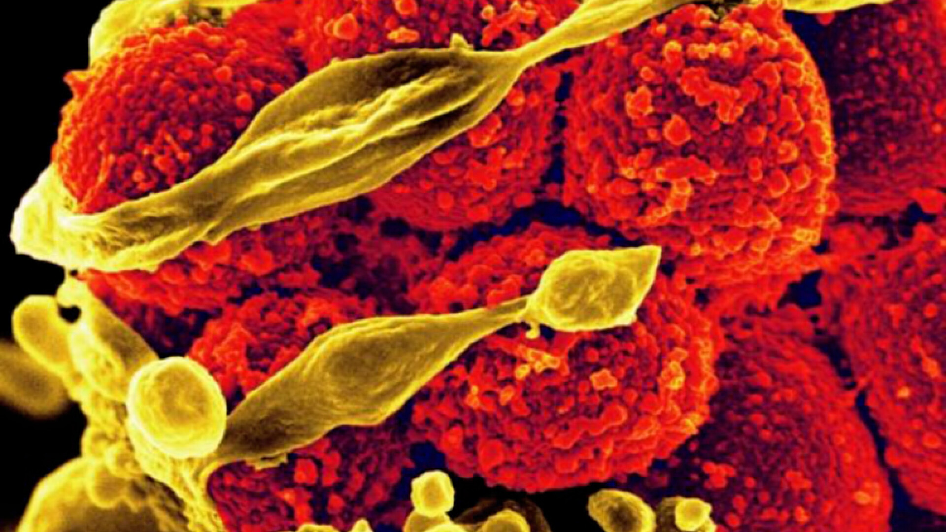 Legatura dintre vitamine si bacteriile din organism. Un academician explica de ce muraturile nu au niciodata acelasi gust