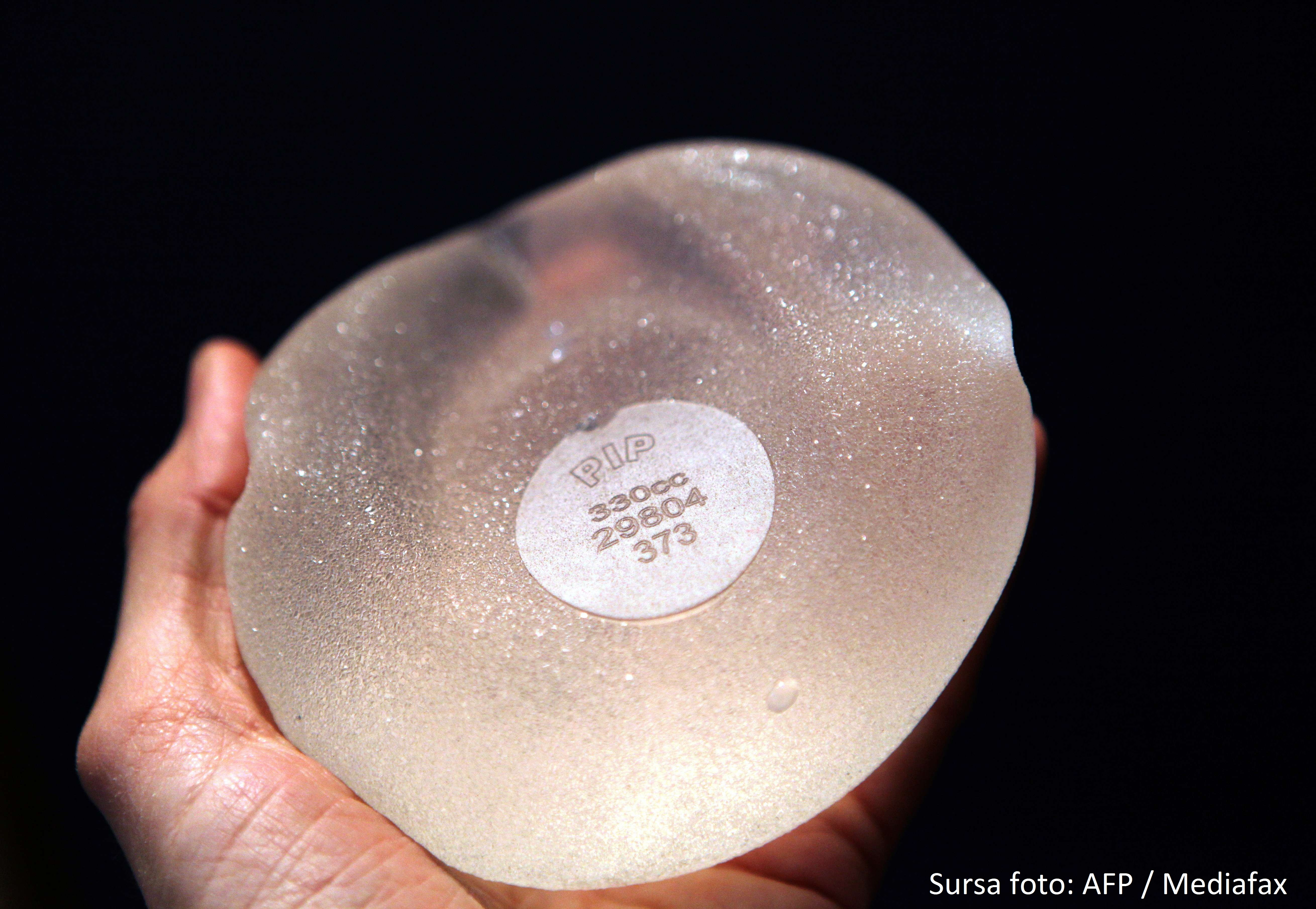 STUDIU. O noua forma de cancer, favorizata de cel mai popular tip de implant mamar din Anglia. 99% dintre femei il aleg