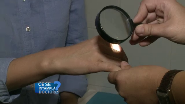 Care sunt semnele atopiei la copii. Riscul pe care il reprezinta afectiunea de care sufera 40% din populatie