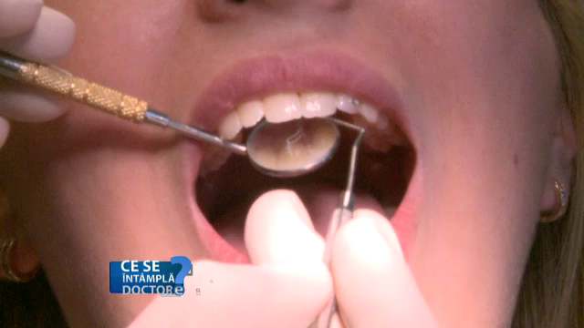 Fumatul poate duce la distrugerea lucrarilor dentare. Recomandarile stomatologilor