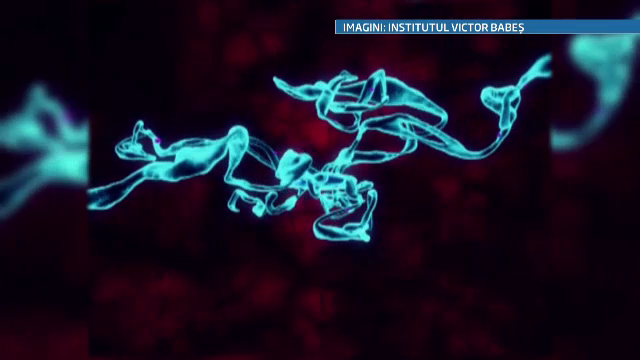 Rezultate entuziasmante dupa investitiile de milioane de euro de la Victor Babes. Celulele minune care pot regenera organe