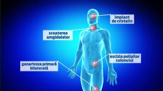 Spitalizarea de 12 ore ar putea elibera saloanele de la 1 iunie. Cine sunt pacientii care vor fi tinuti in spital doar o zi