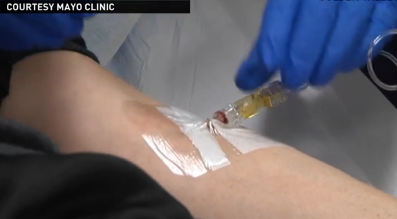 A primit o doza de pojar care putea infecta 10 milioane de oameni. Ce s-a intamplat cu femeia dupa putin timp