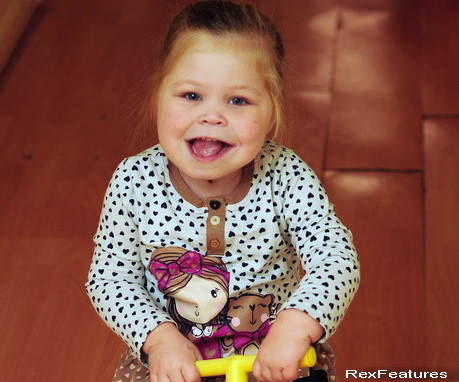 Boala genetica rara, care afecteaza unul din 15.000 de copii din Marea Britanie. Cum arata aceasta fetita in urma cu trei ani