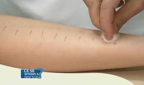 Remedii pentru ameliorarea alergiilor. Cum putem face fata alergenilor si de ce fumatorii sunt cei mai expusi pericolelor