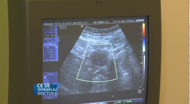 Investigatia de rutina care evalueaza organele interne in 30 de minute. Poate depista cancerul si bolile cardiace