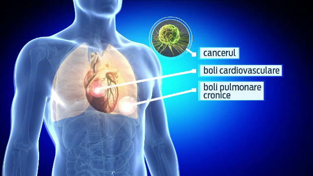 42.000 de romani mor anual din cauza bolilor provocate de fumat. Cum vine statul in ajutorul celor care au acest viciu