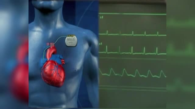 Acuzatii de malpraxis la un spital din Timisoara. Un pacient se plange ca i-a fost implantat degeaba un stimulator cardiac