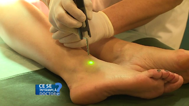 Aspectul pielii, un indicator al sanatatii arterelor. Care sunt semnele aterosclerozei