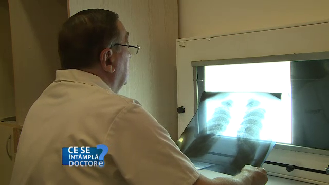 Screeningul pentru cancerul pulmonar facut o data pe an este vital pentru toti fumatorii