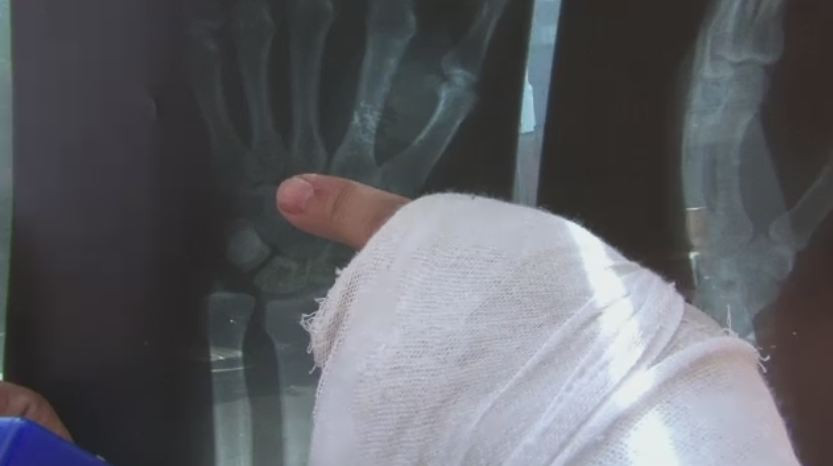 Acuzatii grave la IPJ Tulcea. Un barbat sustine ca a fost batut de un politist: "Mi-a spus ca el face legea in oras"