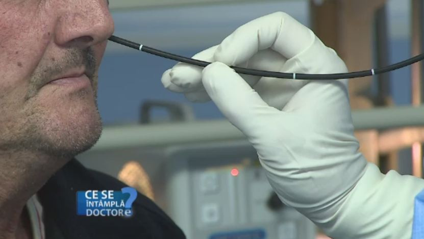 Examenul ORL este obligatoriu o data pe an, in lipsa simptomelor. Ce presupune vizualizarea video-fibroscopica