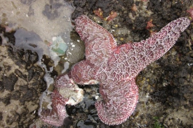 "Este fara precedent": Boala misterioasa care face corpul sa se dezintegreze