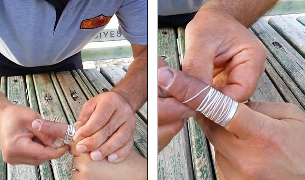 Ai un inel blocat pe deget? Un video devenit viral pe internet arata cum poate fi rezolvata problema fara sapun si margarina