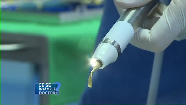 Ce sunt membranele PRF, care ne ajuta sa ne refacem mai usor dupa o interventie chirurgicala la dantura