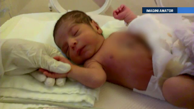 Copilul nascut cu inima in afara toracelui a trecut cu bine primele teste. Ce sanse ii dau medicii italieni care il vor opera